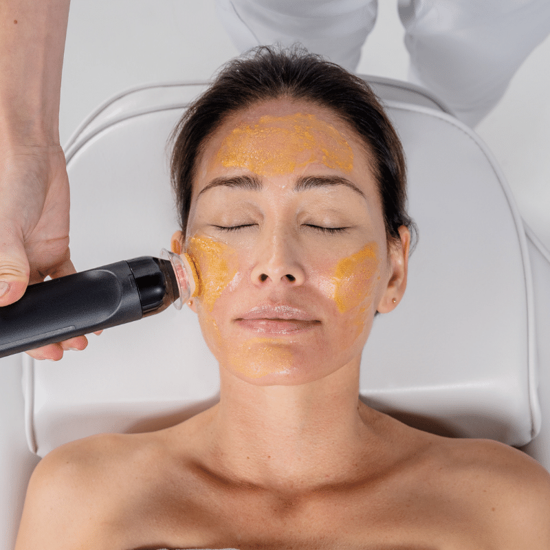 Woman receiving Geneo Glam facial treatment